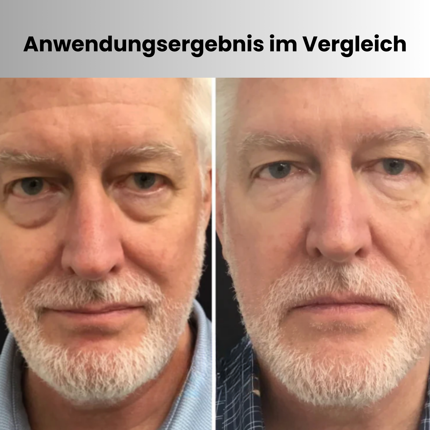 GlättungsDuo™ | Augen-LED & Hals-Pflege