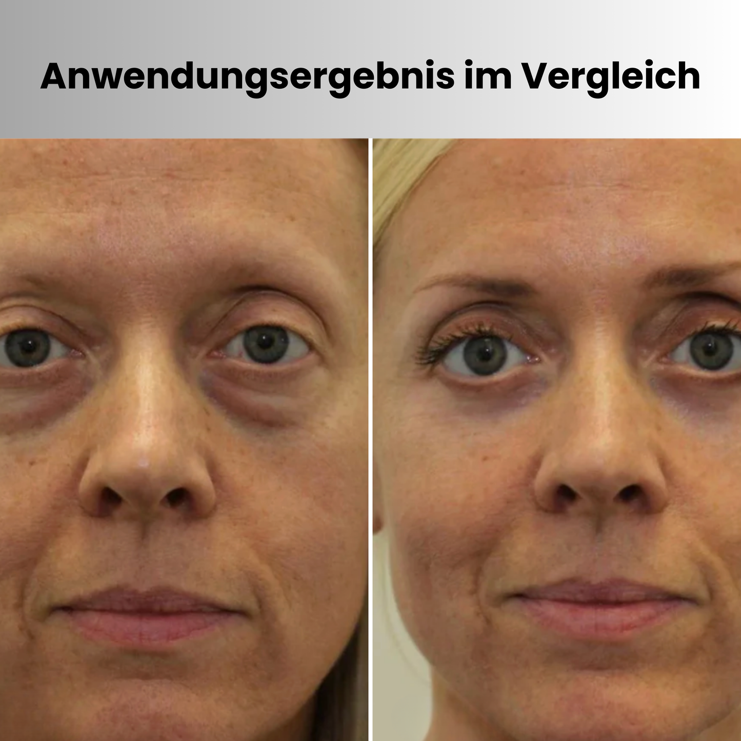 GlättungsDuo™ | Augen-LED & Hals-Pflege