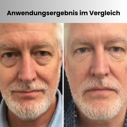 GlättungsDuo™ | Augen-LED & Hals-Pflege