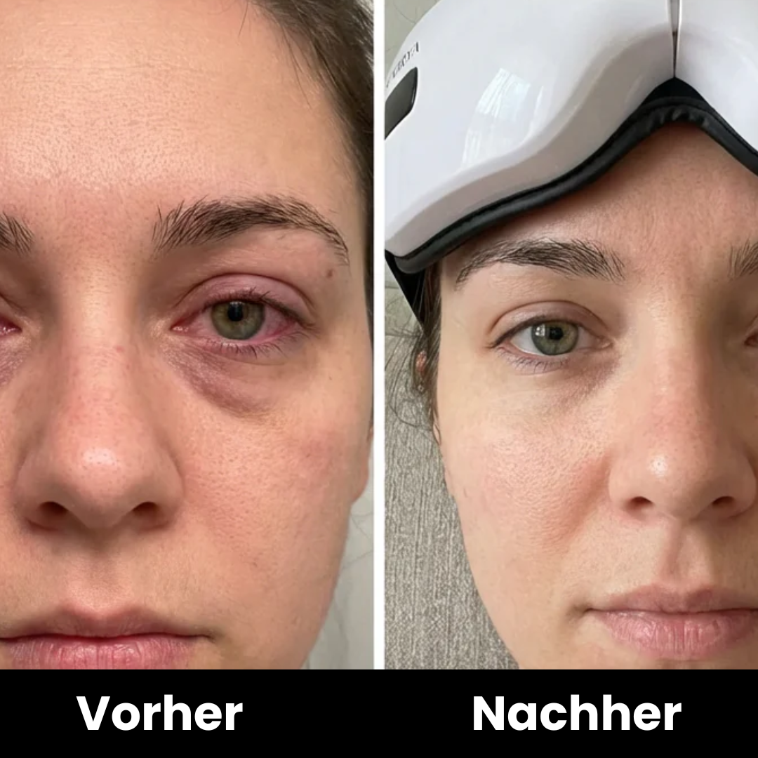 Eye Relief Pro | Sanfte Augenmassage