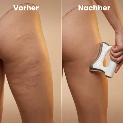 ToneXPro | BodySculpt Gerät